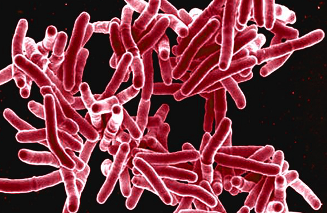 Tuberculosis Microbe | CDC