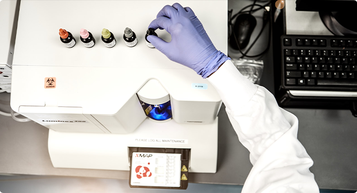 Bead-Based Multiplex Assay Shines in Performance Analysis