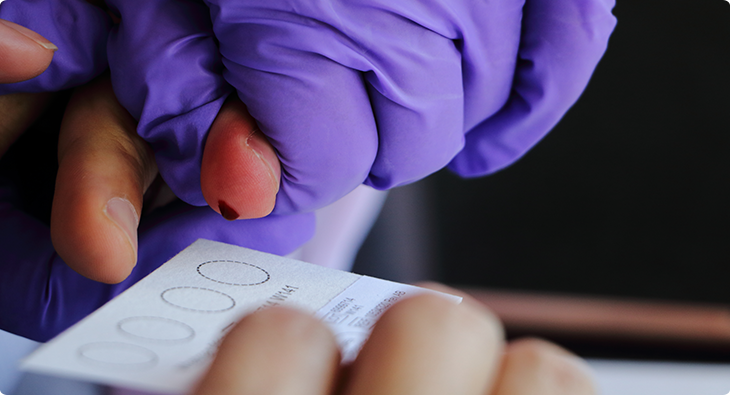 immunoprofile antibody test